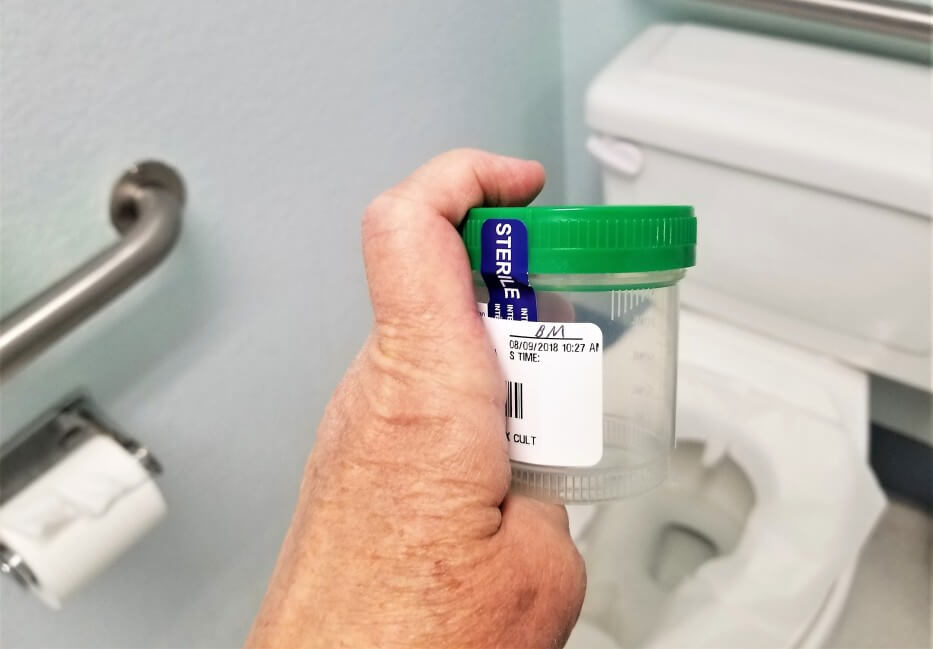 healthcare-and-medicine-a-patient-prepares-to-fill-a-sterile-urine-sample-cup-for-a-required-urine_t20_px080Y (1)